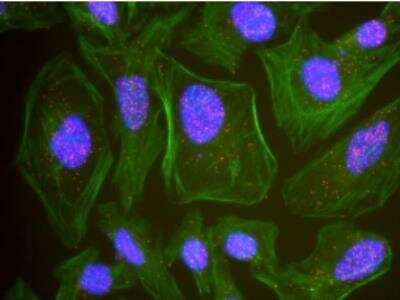 Proximity Ligation Assay: BRCA1 [p Ser1524] Antibody [NB100-200]